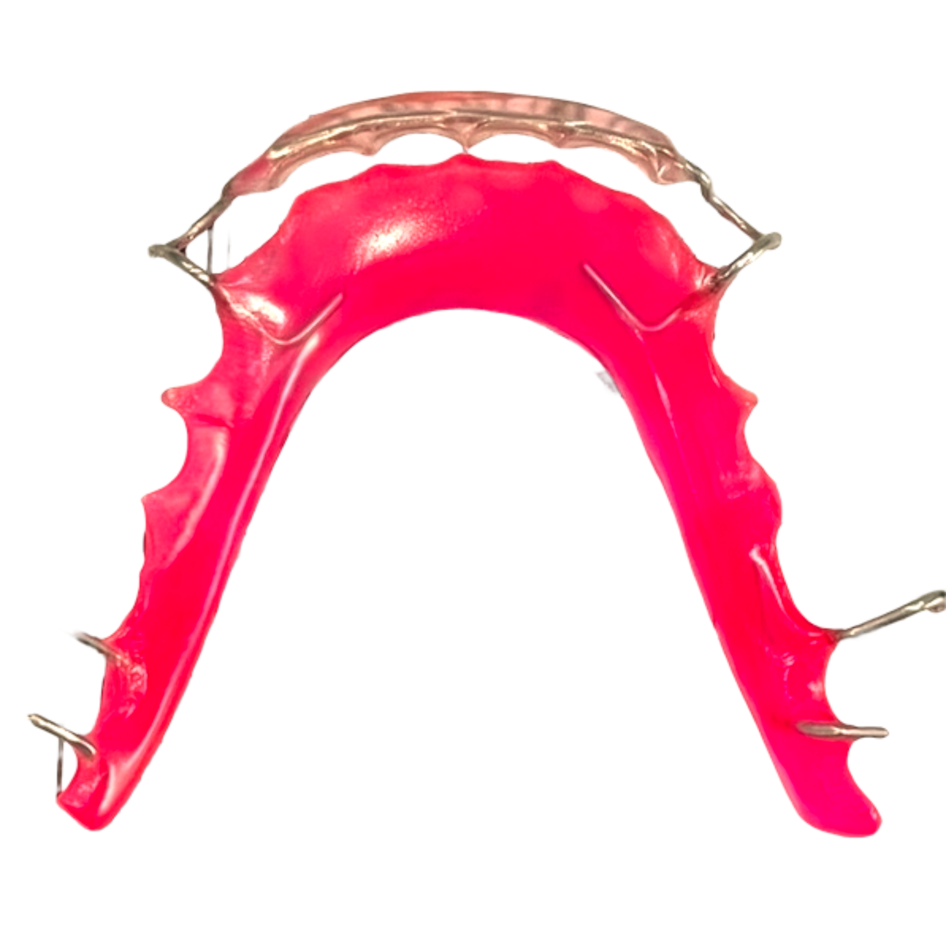 Pink mouthguard with white labial bow, metal frame on a white background